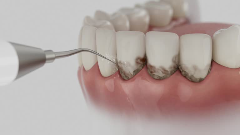 Trusted Dental Crowns And Bridges service in MacArthur, WV - Dentist Open Now